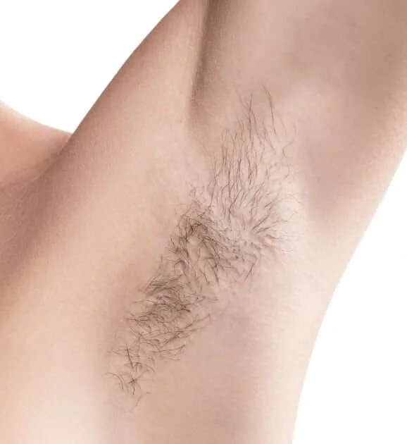 Depilacion antes Depilacion antes